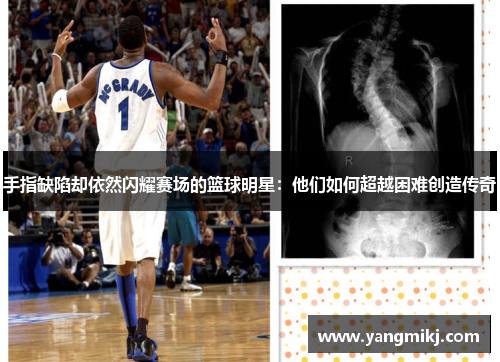 手指缺陷却依然闪耀赛场的篮球明星：他们如何超越困难创造传奇